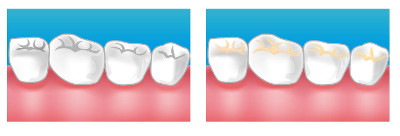 soins dentaire dentiste paris 17